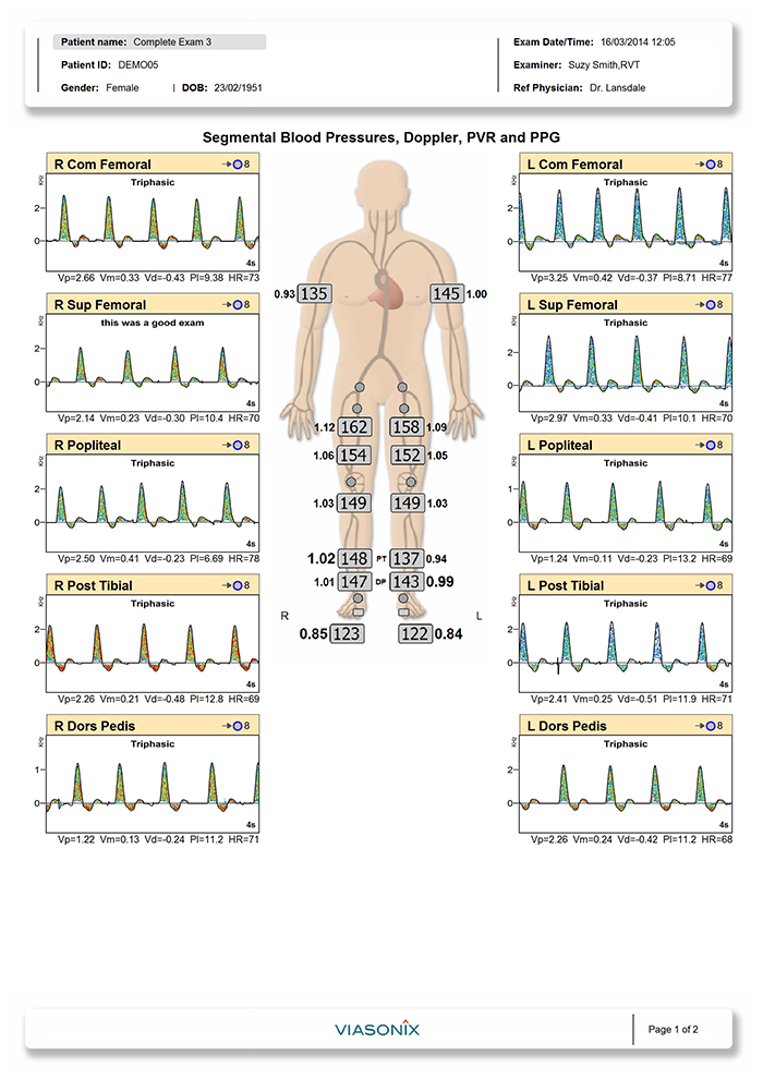 Segmental Blood Pressures for Vascular Diagnosis - Viasonix