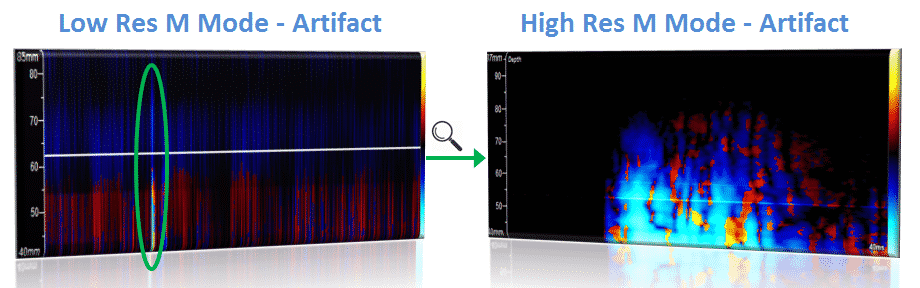 HITS Detection - Artifact Analysis