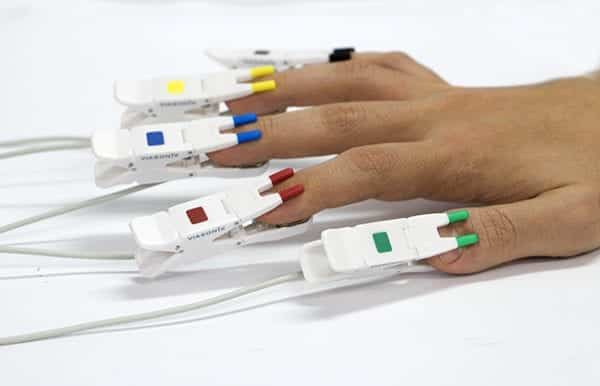 Raynaud's Syndrome Test with Vascular Machine - Viasonix