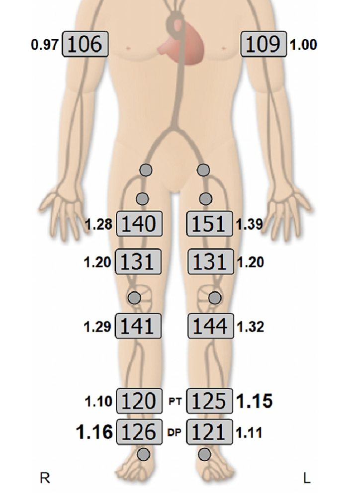 Segmental Blood Pressures Results