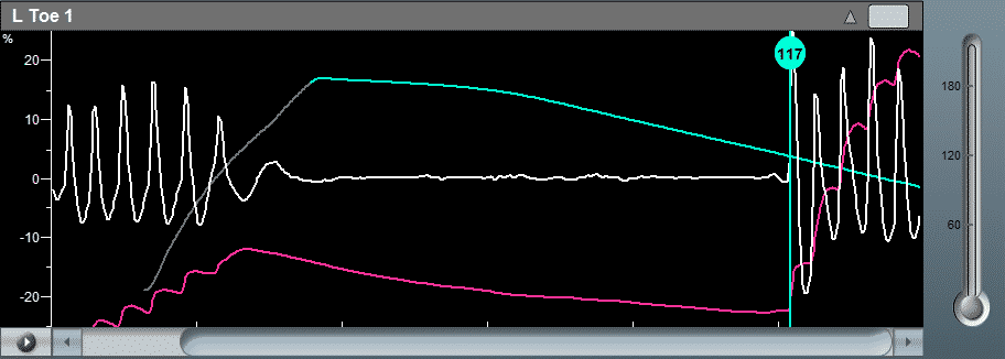 Toe Brachial Index with DC PPG