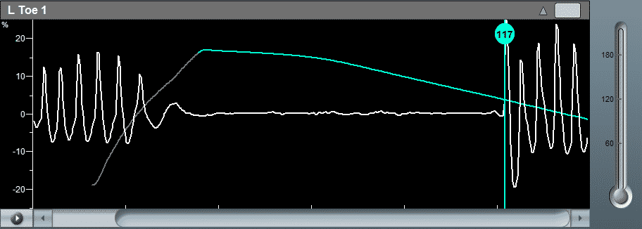 Toe Measurement Using Digit Cuff and PPG Sensor