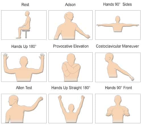 Thoracic Outlet Syndrome (TOS) Test - Viasonix