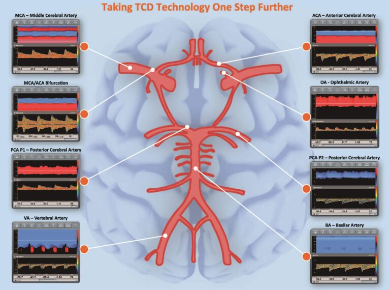 Transcranial Doppler CPT Codes